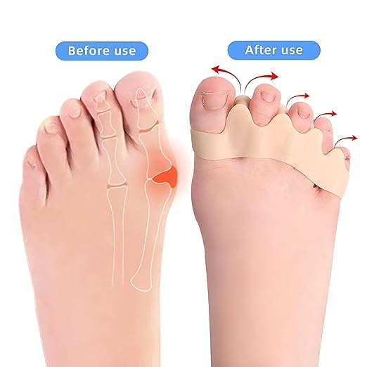 Pair of 7AGAT silicone toe separators for bunion and hammer toe correction with soft medical-grade gel for pain relief.