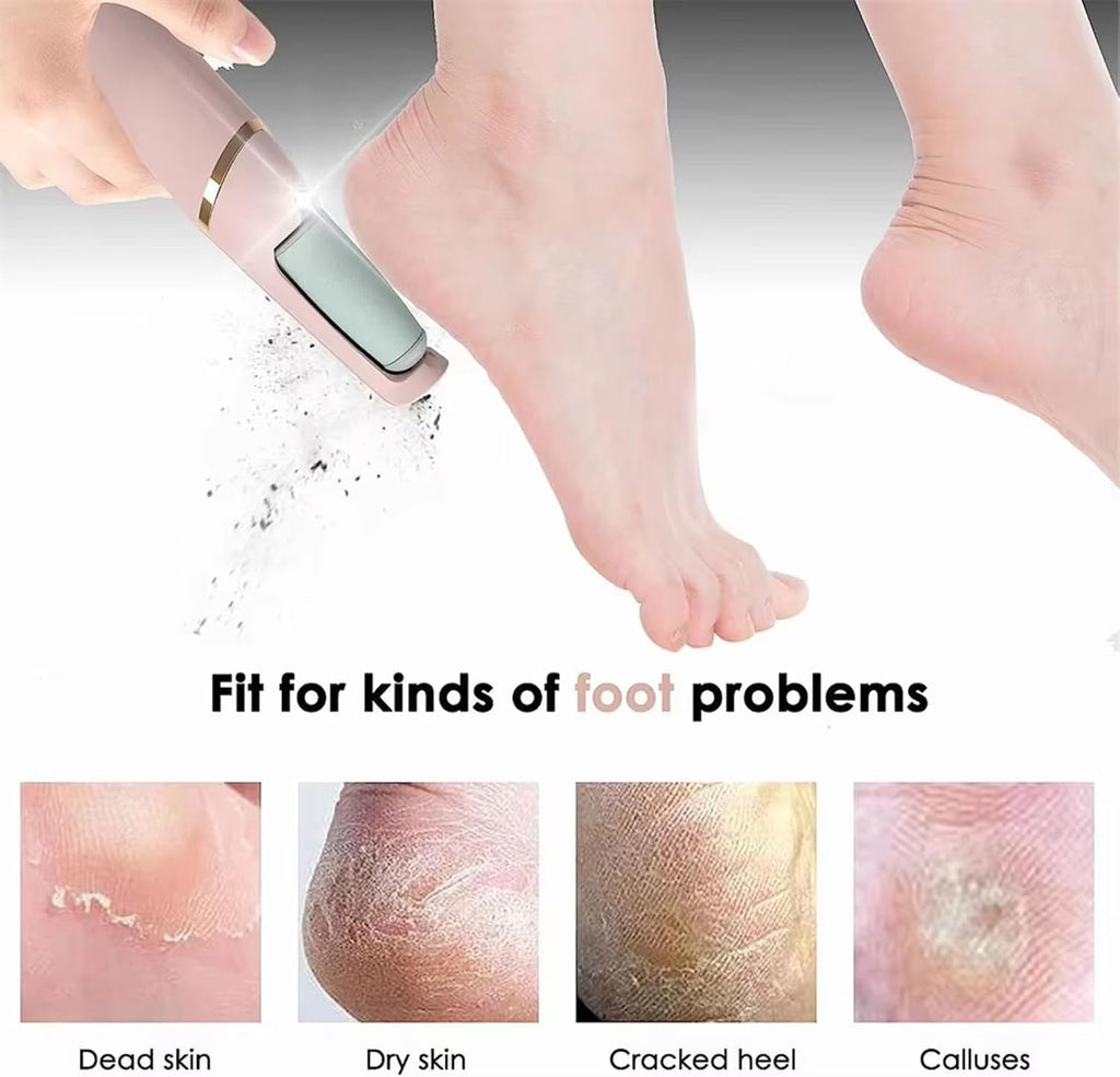 USB Rechargeable Electric Foot File with 2 Speeds for Heel Callus Removal – Portable Size