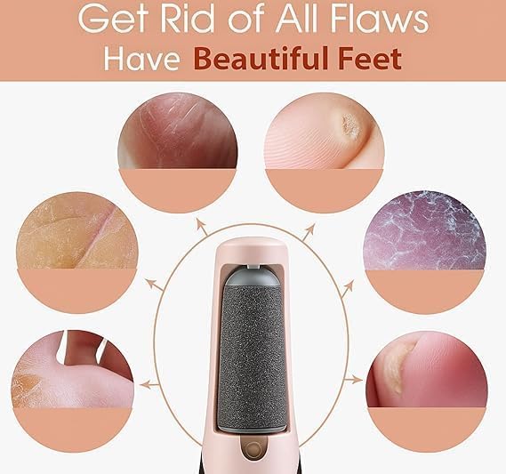 USB Rechargeable Electric Foot File with 2 Speeds for Heel Callus Removal – Portable Size
