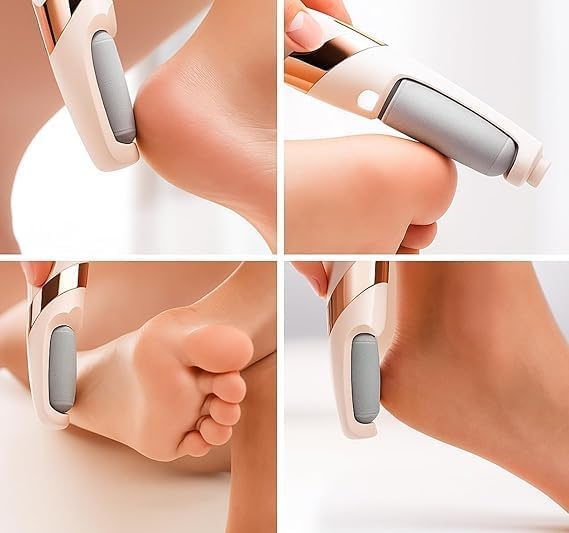 USB Rechargeable Electric Foot File with 2 Speeds for Heel Callus Removal – Portable Size